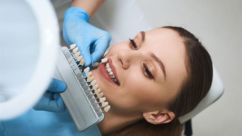 Comprehensive Guide to Dental Veneers: What You Need to Know Before Getting Them