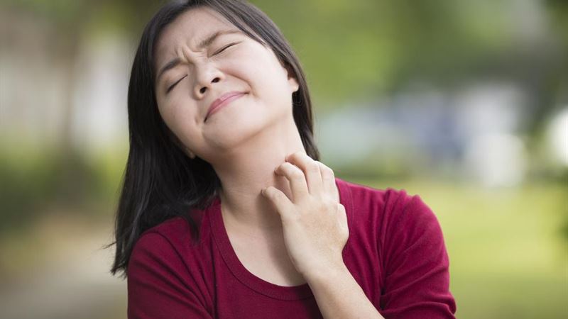 Comprehensive Strategies for Managing Eczema Effectively