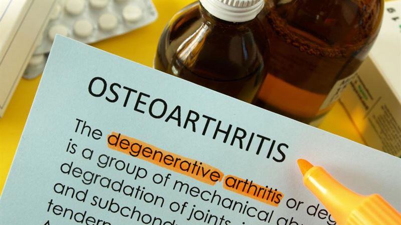 Comprehensive Guide to Managing Osteoarthritis: Treatments and Options