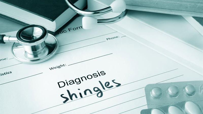 Comprehensive Guide to Managing Shingles: Medical and Natural Approaches