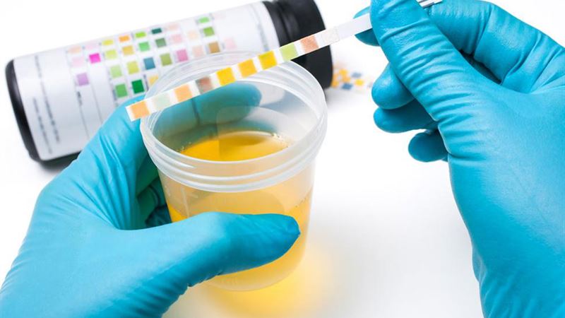 Comprehensive Guide to Analyzing Your Health Through Stool Color Variations