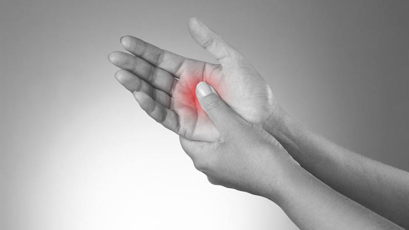 Comprehensive Guide to Managing Dupuytren's Contracture: Treatment Strategies and Options