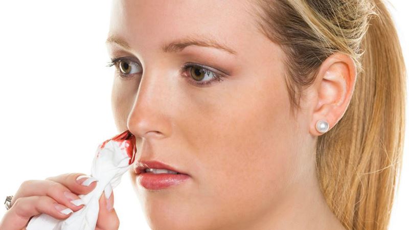 Comprehensive Guide to Understanding the Causes of Nosebleeds