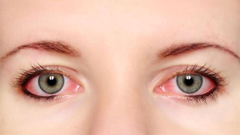 Comprehensive Guide to Proper Contact Lens Maintenance and Safety