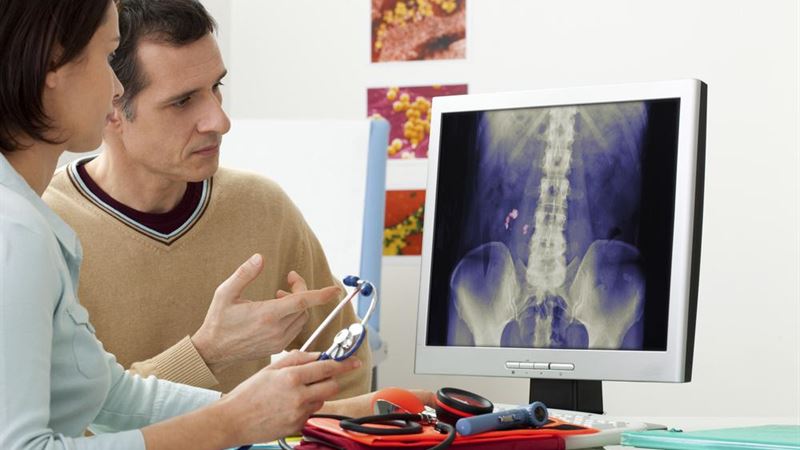 Comprehensive Guide to Recognizing and Managing Kidney Stones