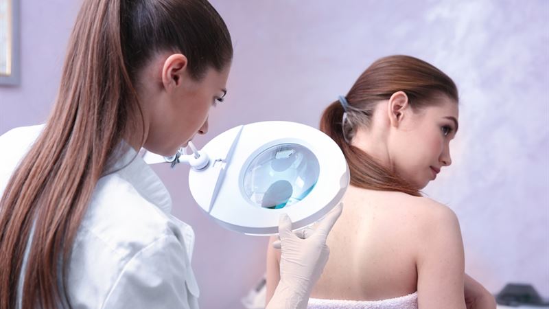 Comprehensive Guide to Lupus: Common Questions Answered