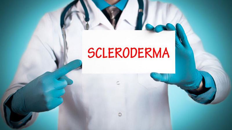 Comprehensive Guide to Early Signs and Management of Scleroderma