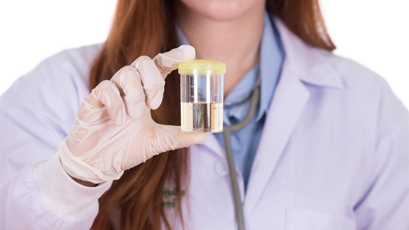 All You Need to Know About E. coli in Urine: Causes, Symptoms, and Treatment