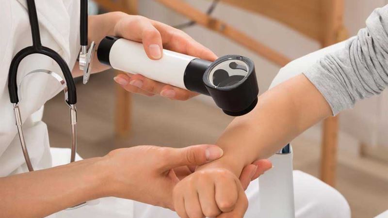 Comprehensive Overview of Psoriasis: Symptoms, Risk Factors, and Potential Health Risks