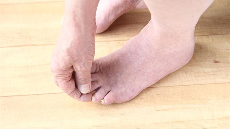 Comprehensive Guide to Managing Foot Pain Associated with Fibromyalgia