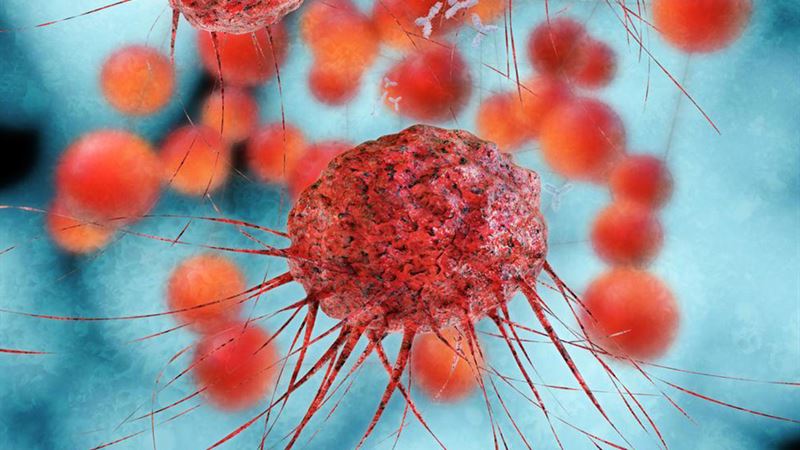 Comprehensive Guide to Recognizing and Understanding Metastatic Breast Cancer Symptoms