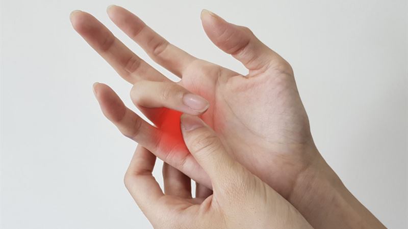 Understanding Trigger Finger: Types, Causes, and Prevention Strategies