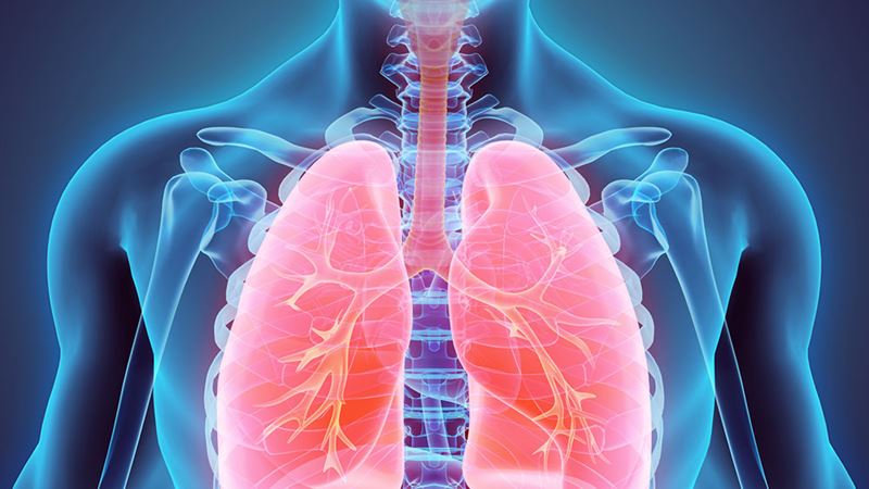 Understanding Non-Small Cell Lung Cancer: Causes, Symptoms, and Comprehensive Treatment Options