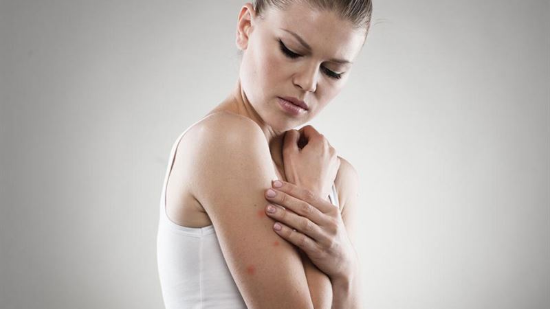 Comprehensive Guide to Managing and Treating Eczema Effectively