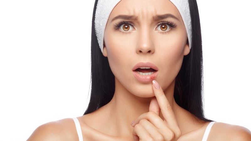 Comprehensive Guide to Herpes: Types, Prevention, and Management Strategies