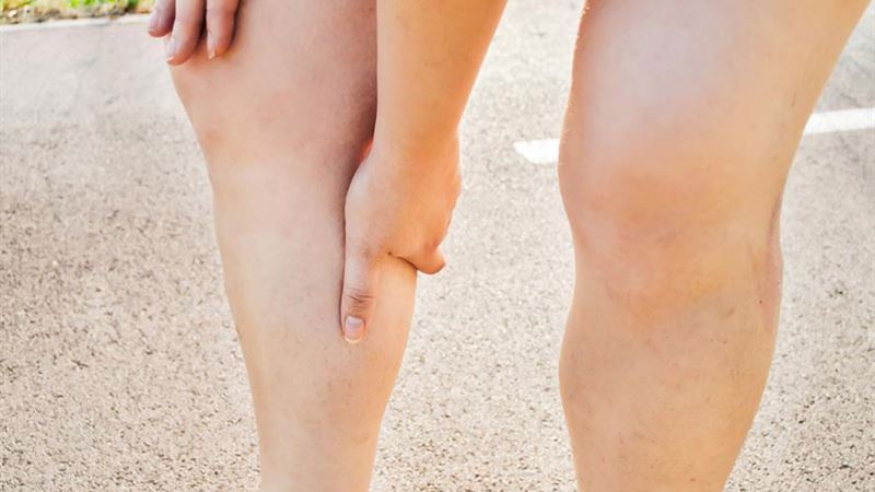 Understanding Nocturnal Leg Cramps: Causes, Treatments, and Prevention Strategies