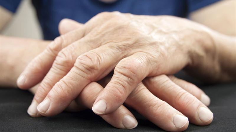 Comprehensive Guide to Rheumatoid Arthritis: Symptoms, Causes, and Effective Management