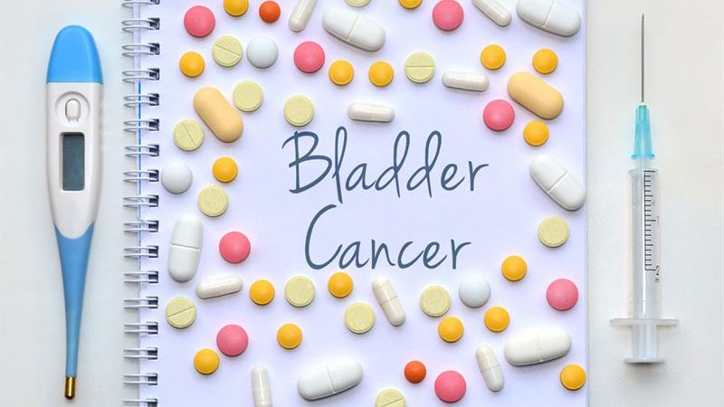 Comprehensive Guide to the Different Stages of Bladder Cancer