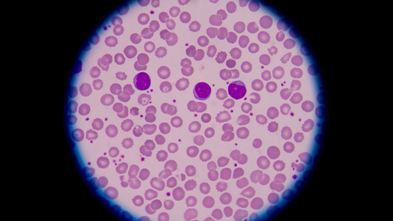 Comprehensive Guide to Blood Disorders: What You Need to Know