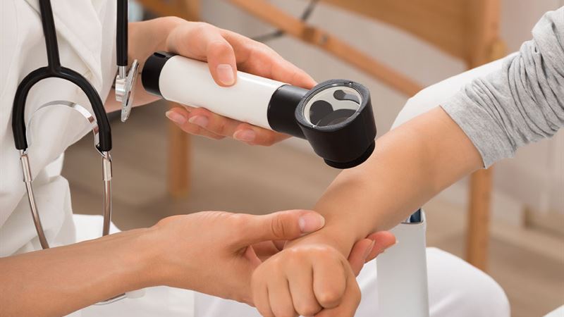 Comprehensive Guide to Eczema Relief: Effective Skincare Solutions and Natural Home Remedies