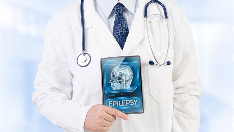 Comprehensive Overview of Lifestyle Factors Influencing Epileptic Seizure Management