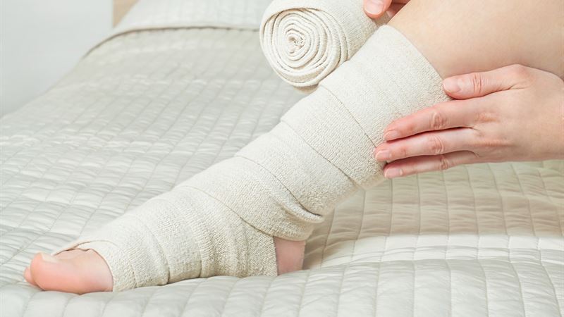 Comprehensive Strategies for Preventing and Managing Venous Thrombosis at Home