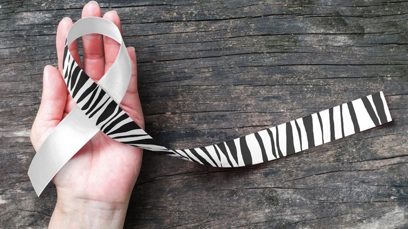 Understanding Carcinoid Neuroendocrine Tumors: Causes, Symptoms, and Prevention