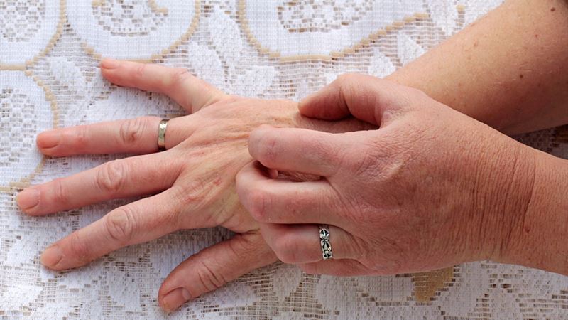 Comprehensive Guide to Identifying and Treating Insect Bites