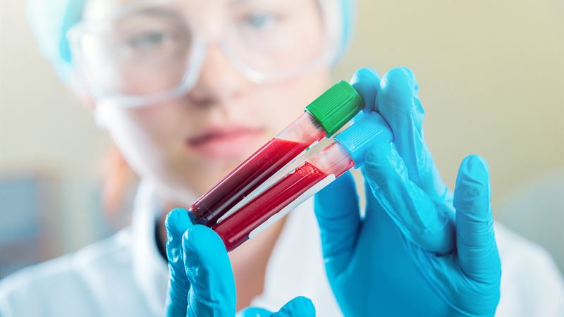 Understanding Blood Cancers: Types, Symptoms, and Treatment Options