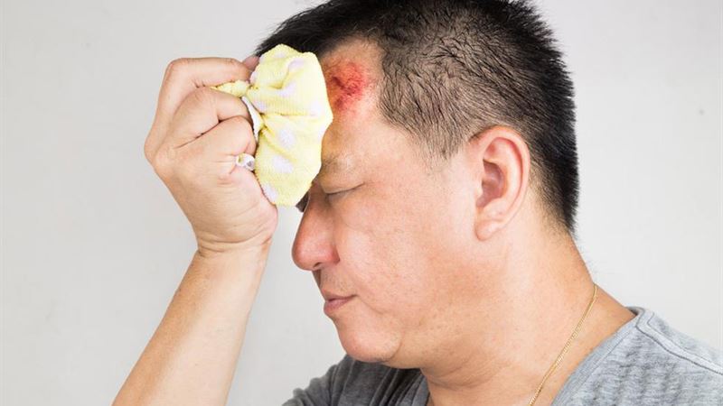 Comprehensive Guide to Managing and Treating Concussions Effectively