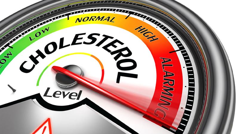 Comprehensive Guide to Managing and Understanding Cholesterol Levels