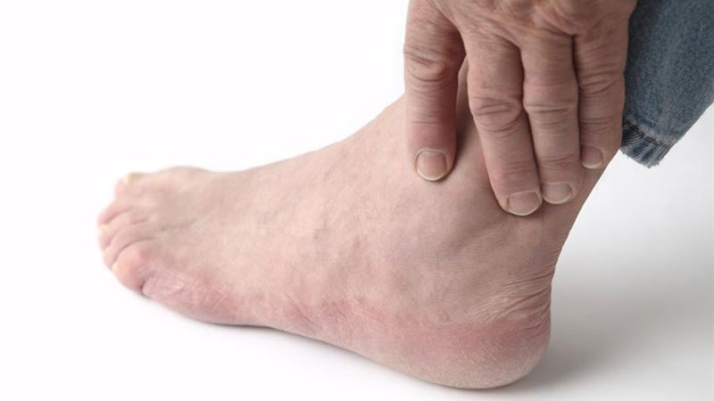 Common Causes and Effective Treatments for Swollen Ankles