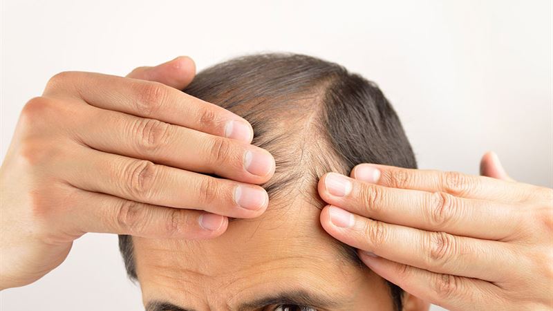 Effective Strategies for Controlling Hair Loss and Promoting Hair Regrowth