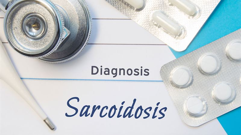 Understanding the Key Factors That Increase the Risk of Sarcoidosis