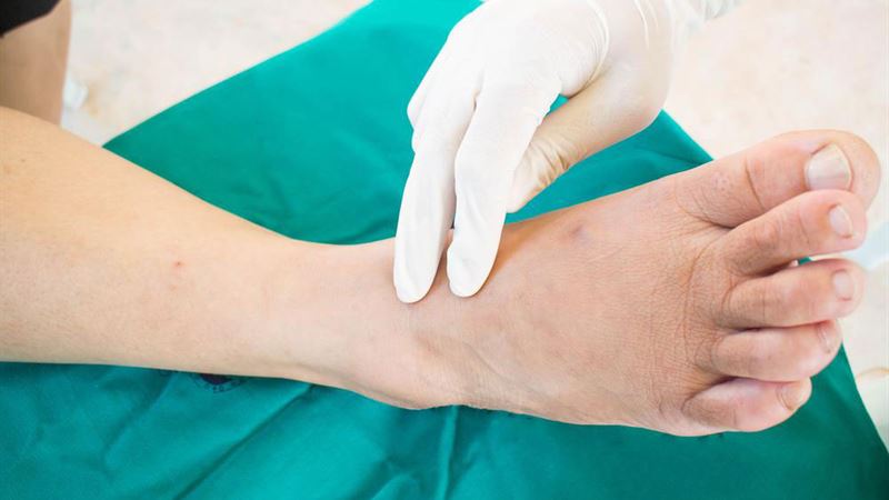 Understanding Neuropathy: Causes, Symptoms, and Treatment Options