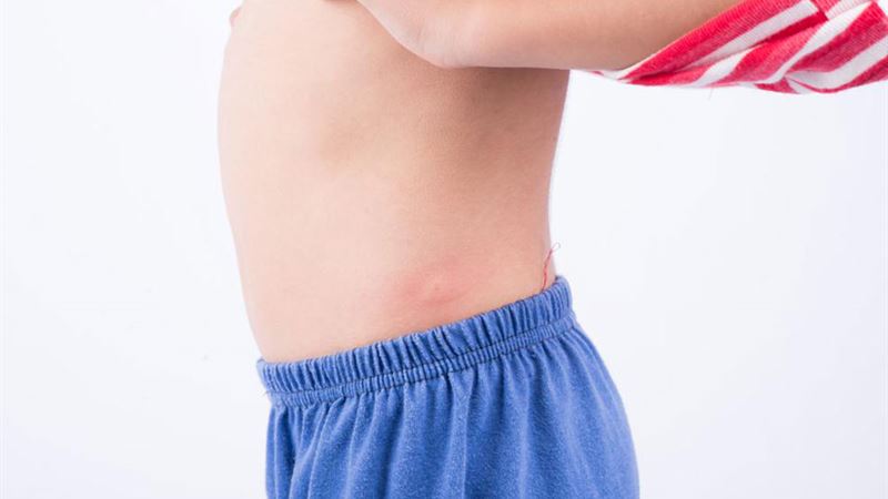 Comprehensive Guide to 10 Common Types of Skin Rashes and Their Causes
