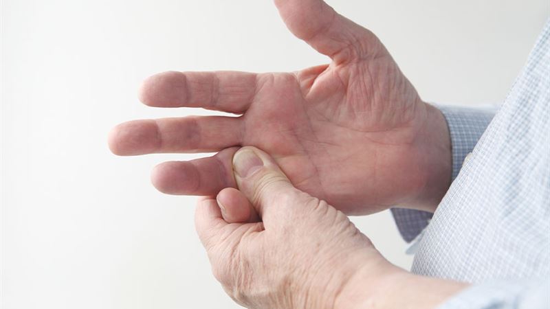 Effective Strategies to Prevent and Manage Rheumatoid Arthritis