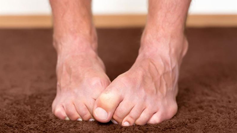 Comprehensive Guide to Foot Neuropathy: Symptoms, Causes, Diagnosis, and Effective Treatment Options