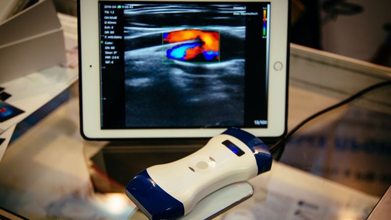 Comprehensive Guide to Portable Ultrasound Devices: Types, Features, and Best Options