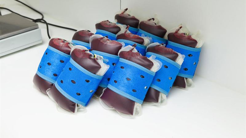 Choosing the Optimal Cord Blood Banking Service: A Comprehensive Guide