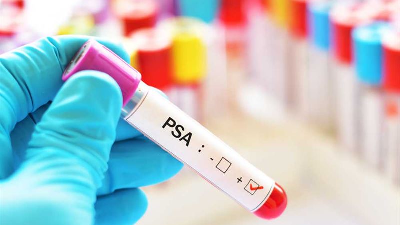 Understanding Age-Related Normal PSA Levels: A Comprehensive Guide