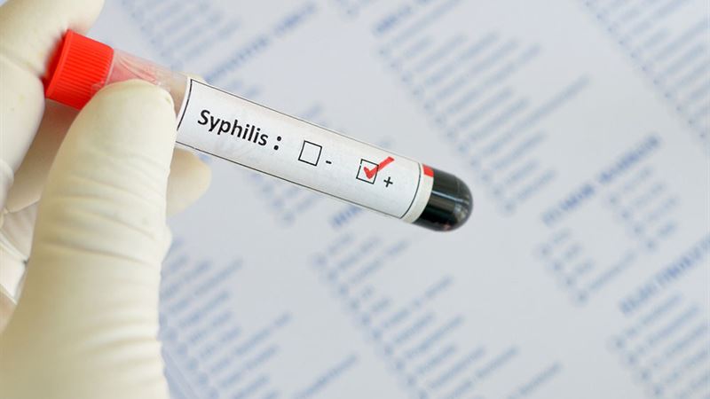 Understanding Syphilis: Recognizing Early Symptoms and Diagnostic Procedures