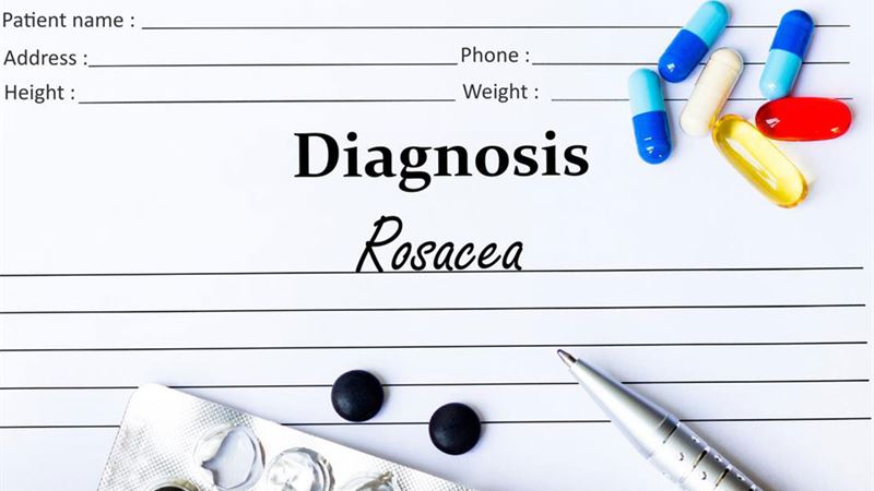 Comprehensive Guide to the Most Effective Treatments for Rosacea