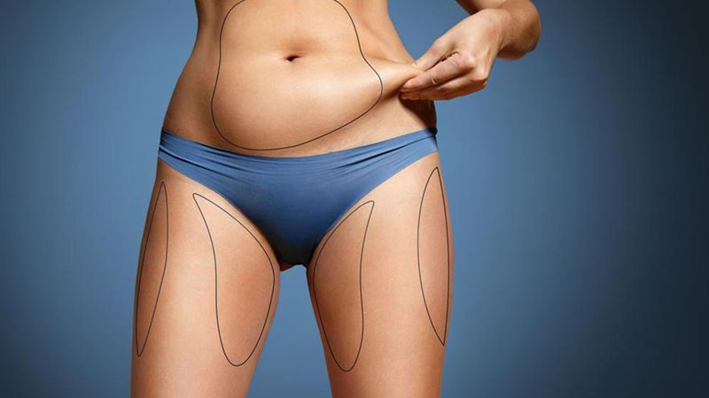 Comprehensive Guide to CoolSculpting Fat Reduction Therapy