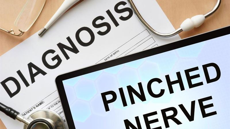 Comprehensive Guide to Pinched Nerve Relief: Causes, Symptoms, and Effective Treatment Options