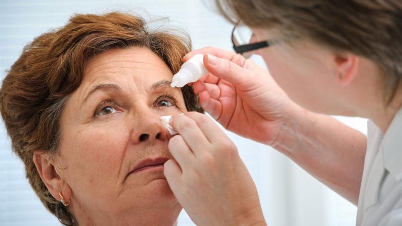 Comprehensive Guide to Causes, Symptoms, and Effective Treatments for Dry Eyes