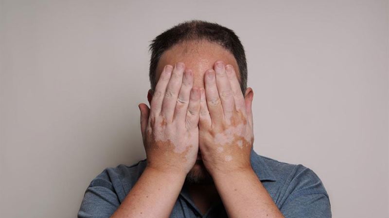 Comprehensive Guidance on Managing and Treating Hepatitis Patients