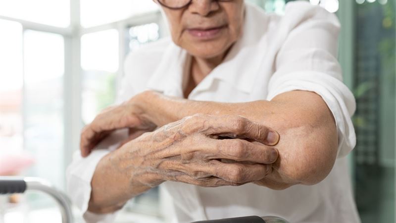 Comprehensive Guide to Managing Pruritus in Older Adults: Causes, Signs, and Effective Remedies