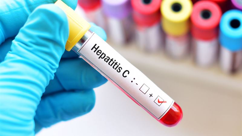 Comprehensive Overview of Hepatitis: Types, Causes, and Prevention Strategies
