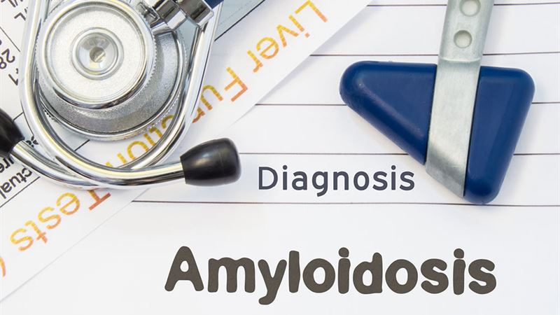 Comprehensive Overview of Hereditary Amyloidosis: Types, Causes, and Treatments